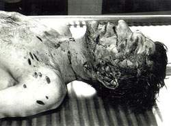 Victim of William MacDonald