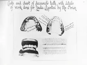 Forensic Investigations in 1930s Australia A Deep Dive into the Pyjama Girl Case
