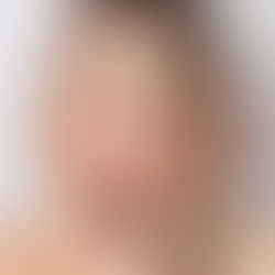 Грижа за лицето