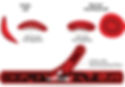 ypm_sicklecell_diagram_320