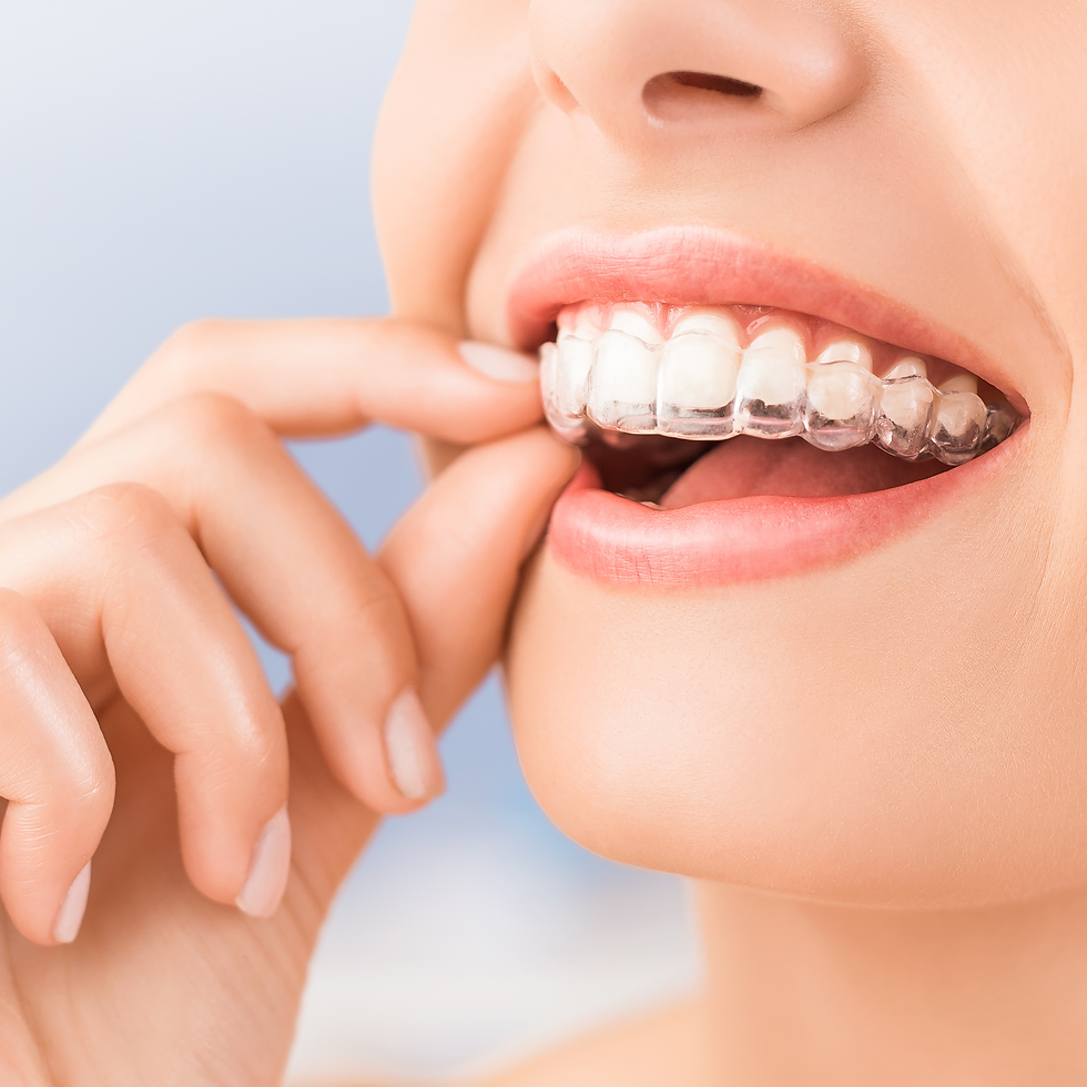 Invisalign
