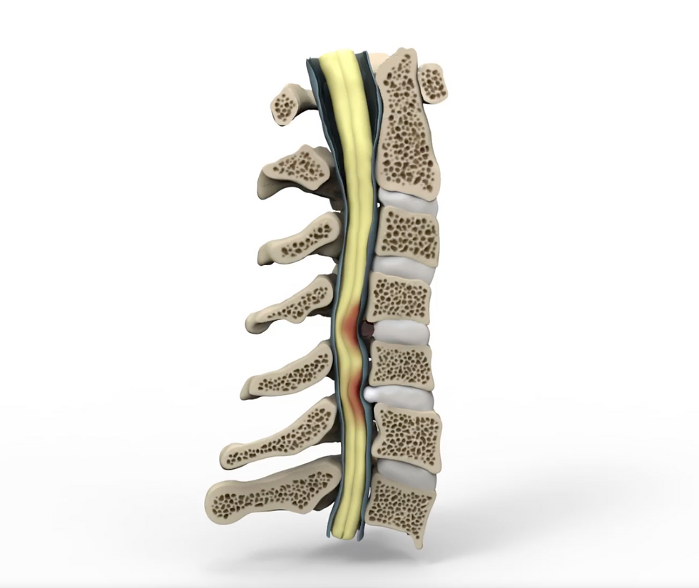 Cervical Spine - Sagittal