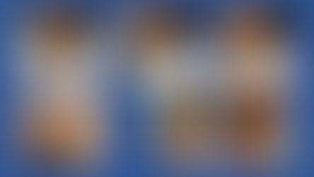 GOITRE OPERE SANS CICATRICE ( TOETVA )