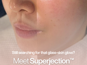 Superjection Korean Skin Booster NZ | Advanced Microneedling Facial | Totally RAD Beauty