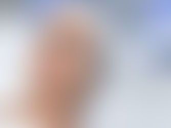 Dermapen Microneedling in Christchurch: Precision Skin Rejuvenation for Smoother, Brighter Skin