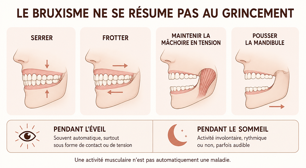 Infographie présentant les formes du bruxisme : serrer ou frotter les dents, maintenir la mâchoire en tension et pousser la mandibule, pendant l’éveil ou le sommeil.
