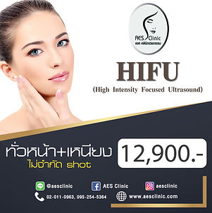 hifu หน้า+เหนียง