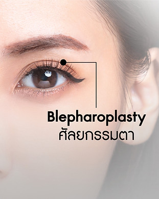 Blepharoplasty