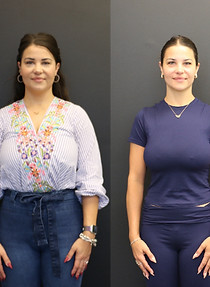 Medical Weight Loss In Aurora, OH