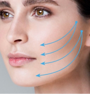 APTOS mid and low face thread lift