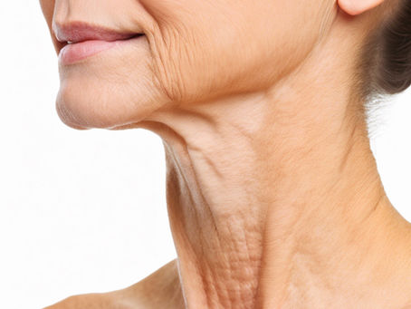 Neck Bands Treatment: The Non-Surgical “Nefertiti” Neck Lift
