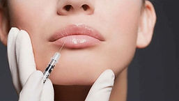 Lip Filler