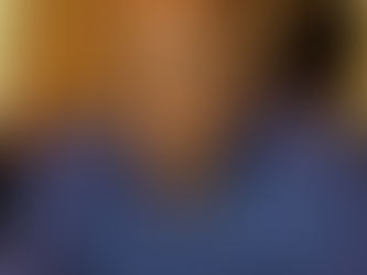 Scarface on Dialysis after Covid-19 Complications caused Kidney Failure