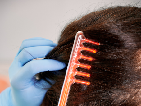 Queda de cabelo: como a alta frequência pode ser uma aliada no tratamento