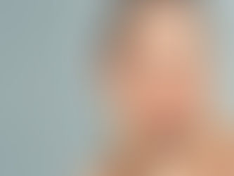 Microagulhamento com PDRN e Exossomos: tecnologia avançada para rejuvenescimento da pele