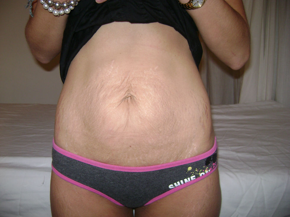 After 8 Treatments