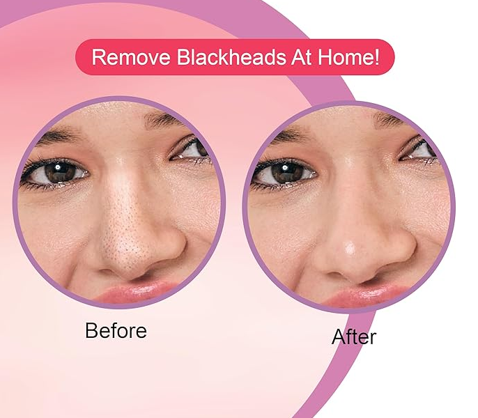 Thumbnail: DR.Rashel Strawberry Nose Strips For Pore Cleansing 10pcs