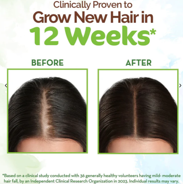 MAMAEARTH Rosemary Hair Growth Oil - 200 ML