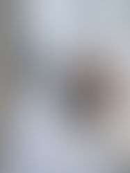 Close Quarters Syndrome