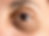 Dark Eye Circles 1 copy.PNG