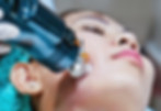 Microneedling + RF_edited.jpg