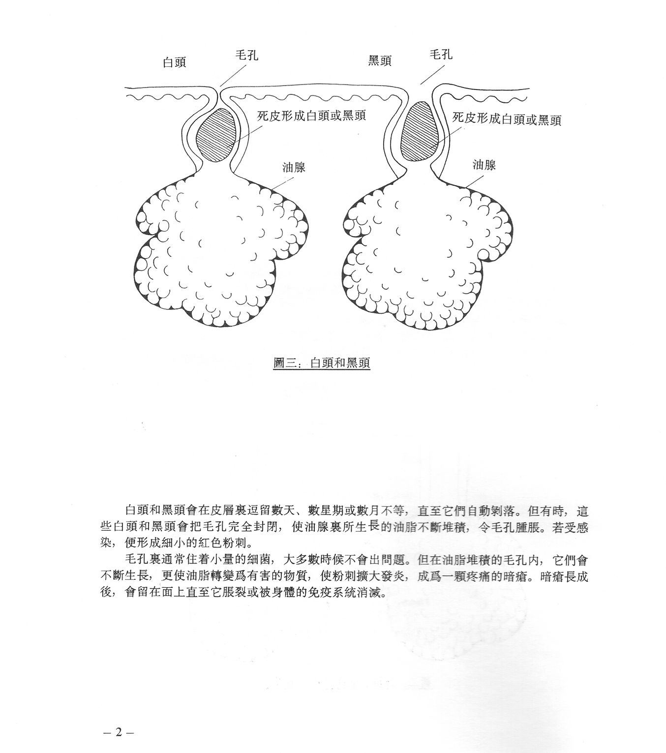 Chinese Acne Information Drleeinfosite Chinese Acne Information Drleeinfosite