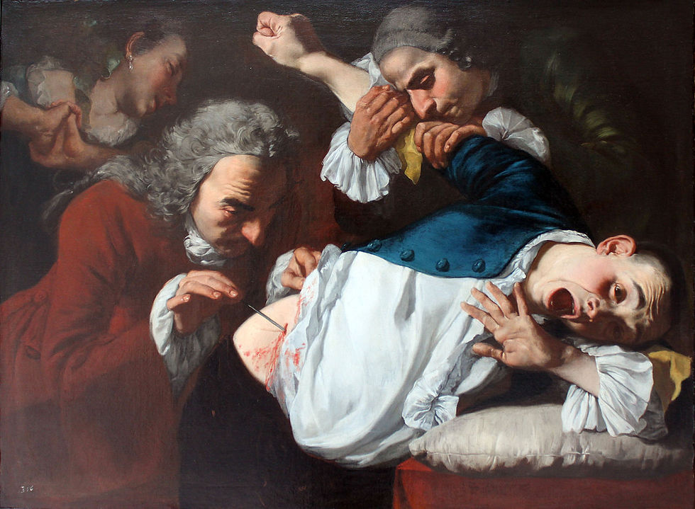 L'Opération, 1753-54