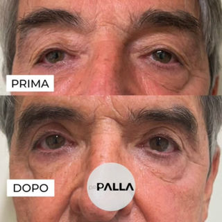 Ludovico Palla chirurgo plastico chirurgia plastica ricostruttiva estetica blefaroplastica Roma