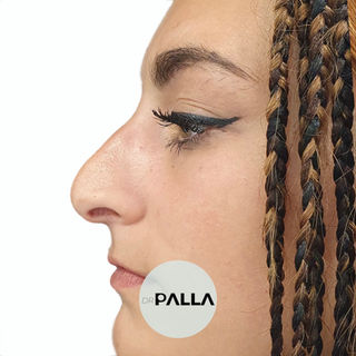 Ludovico Palla chirurgo plastico chirurgia plastica ricostruttiva estetica rinoplastica Roma