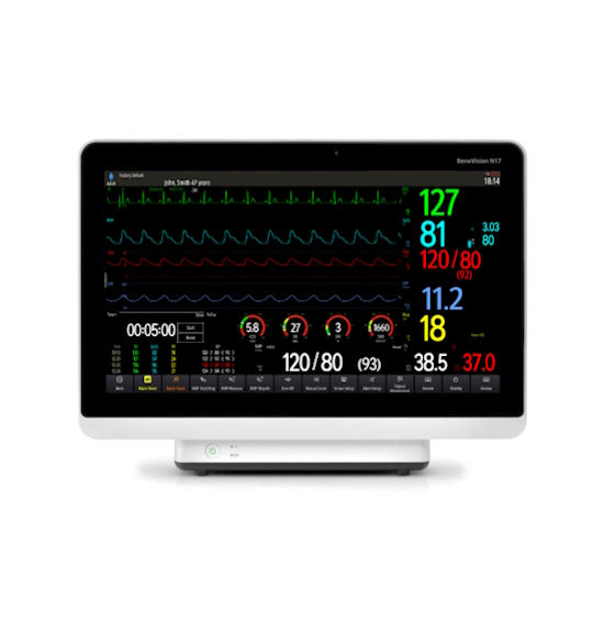 Wireless Health Monitor_2_edited.jpg