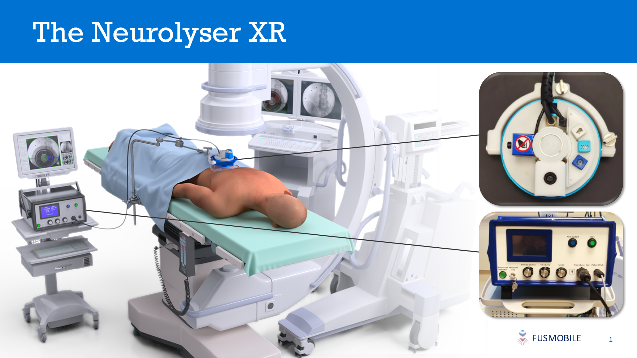 Patient receiving Neurolyser XR focused ultrasound treatment, lying face-down on the procedure table with the device resting on the lower back