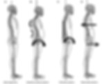 posture.jpg