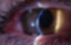 0932101 photo OD hydrop.jpg