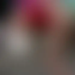 servidor amputa pé para receber seguro