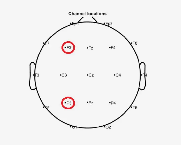 Neural Connectivity Changes to tACS: A Preliminary eLORETA EEG Study. Diagram of a head displaying electrode positions F3 and P3 circled in red, titled "Channel locations."