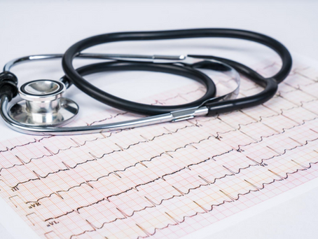 Posizionamento corretto degli elettrodi ECG: guida pratica per operatori sanitari