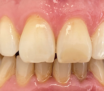 Captura de pantalla 2022-09-02 a la(s) 17.22.00.png