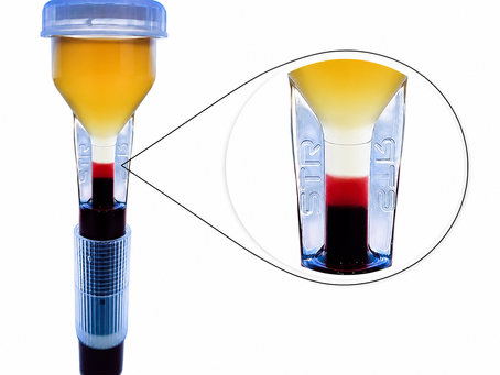 STR Biyoteknoloji – Highcell PRP Kit - En iyi PRP Kitinin Kriterleri