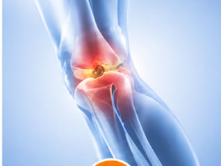PRP in Sports Medicine: Benefits of Platelet-Rich Plasma for Sports Injury Recovery