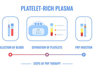 PRP (Platelet Rich Plasma) hangi hastalıklarda kullanılır? Ortopedi, saç restorasyonu, estetik tıp, üroloji ve jinekolojide PRP uygulamalarını bilimsel çalışmalar ışığında inceleyin.