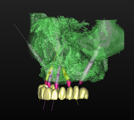 Screen Shot 2019-05-04 at 9.45.30 pm.png