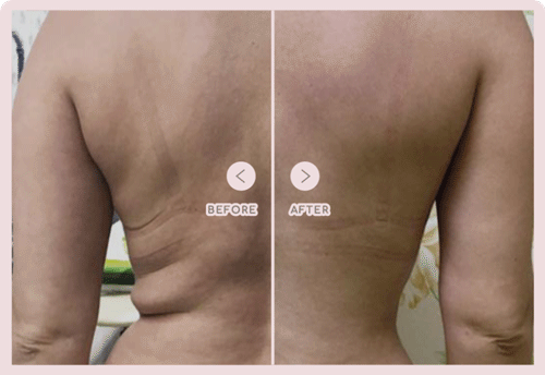 onda-case2.gif