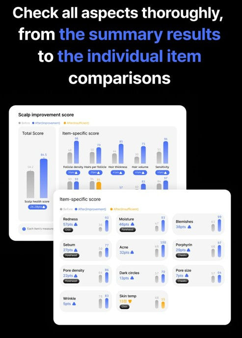 Thumbnail: Wireless Ai Scalp Scanner