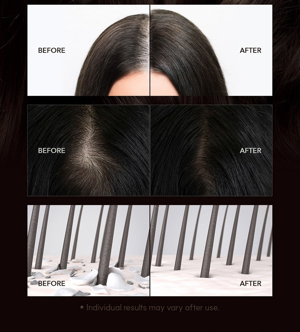 Close-up scalp scan showing clean hair follicles and healthy scalp after deep cleansing