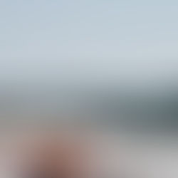 Sunburn Easily? It Might be Your Medications