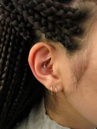 Daithpiercing og migrene?