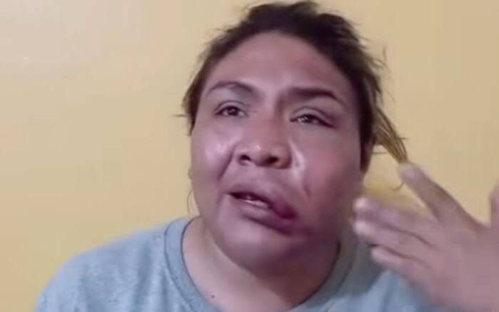 Michelle mujer trans golpeada amame trans mx
