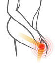 knee pain_edited.jpg