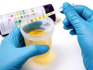 Exame pós jornada: cuidados na coleta