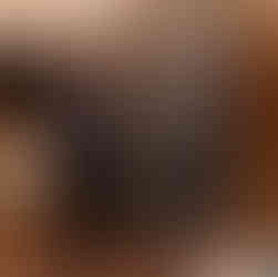 زراعة الدعامة الذكرية في العراق اختيار عيادة الدكتور انس العبيدي كـ مركز مرجعي عالمي من قبل ريجيكون